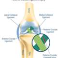 Protect Your Knee From A Posterior Cruciate Ligament Injury