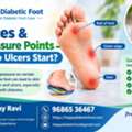 Diabetes & Foot Pressure Points &ndash; Where Do Ulcers Start? -Dr Uday Ravi