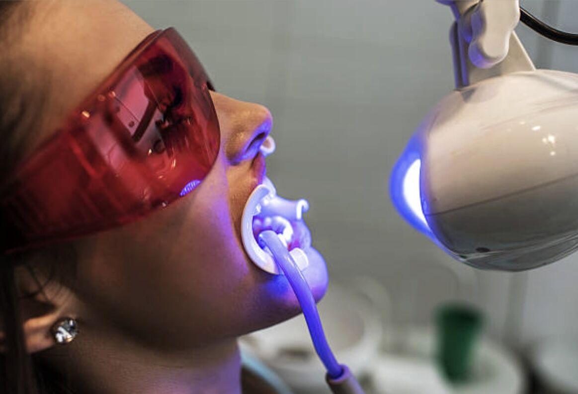 Auckland, Health, Philips Zoom Whitening In Mount Roskill