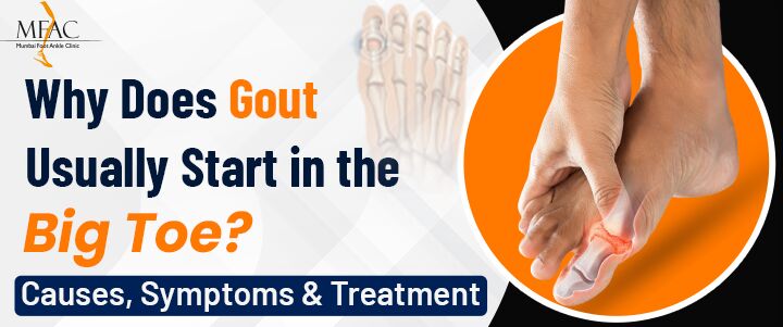 Mumbai, Health, Gout Attacks Making Walking Difficult? Find Specialized Care | Dr. Pradeep Moonot