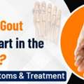 Gout Attacks Making Walking Difficult? Find Specialized Care | Dr. Pradeep Moonot