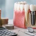 Dental Implant, Planned First. Priced Honestly.