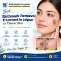 Best Birthmark Removal Treatment In Jaipur For Clearer Skin
