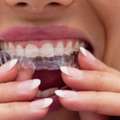 Understanding Teeth Grinding And The Importance Of Professional Dental Care