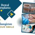Grab Offers And Deals On Tooth Implants Solution