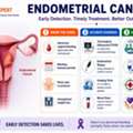 Expert Endometrial Cancer Doctor In Mumbai | Dr. Sanket Shah