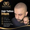 Natural-Looking Hair Tattoo For Men | Skulltec Scalp Micropigmentation