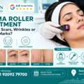 INR 1500,  Derma Roller Treatment In Jaipur For Acne Scars