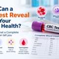 What Can A CBC Test Reveal About Your Overall Health?