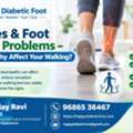 Diabetes & Foot Balance Problems &ndash; Can Neuropathy Affect Your Walking? - Dr Uday Ravi
