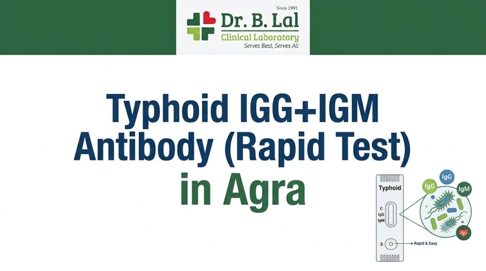 Lucknow, Health & Beauty Items, INR 250,  Typhoid Screening Test In Agra | Detect Active & Past Infection | Dr. B. Lal Lab