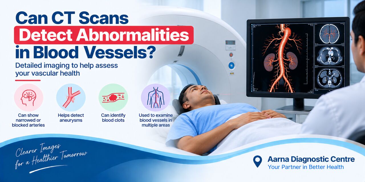 Meerut, Health, Can CT Scans Detect Abnormalities In Blood Vessels?
