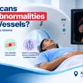 Can CT Scans Detect Abnormalities In Blood Vessels?
