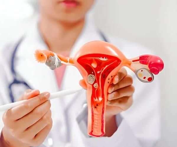 New Delhi, Health, Best Endometriosis In Delhi