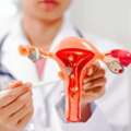 Best Endometriosis In Delhi