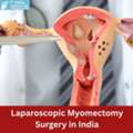 Robotic Myomectomy Surgery Cost In India