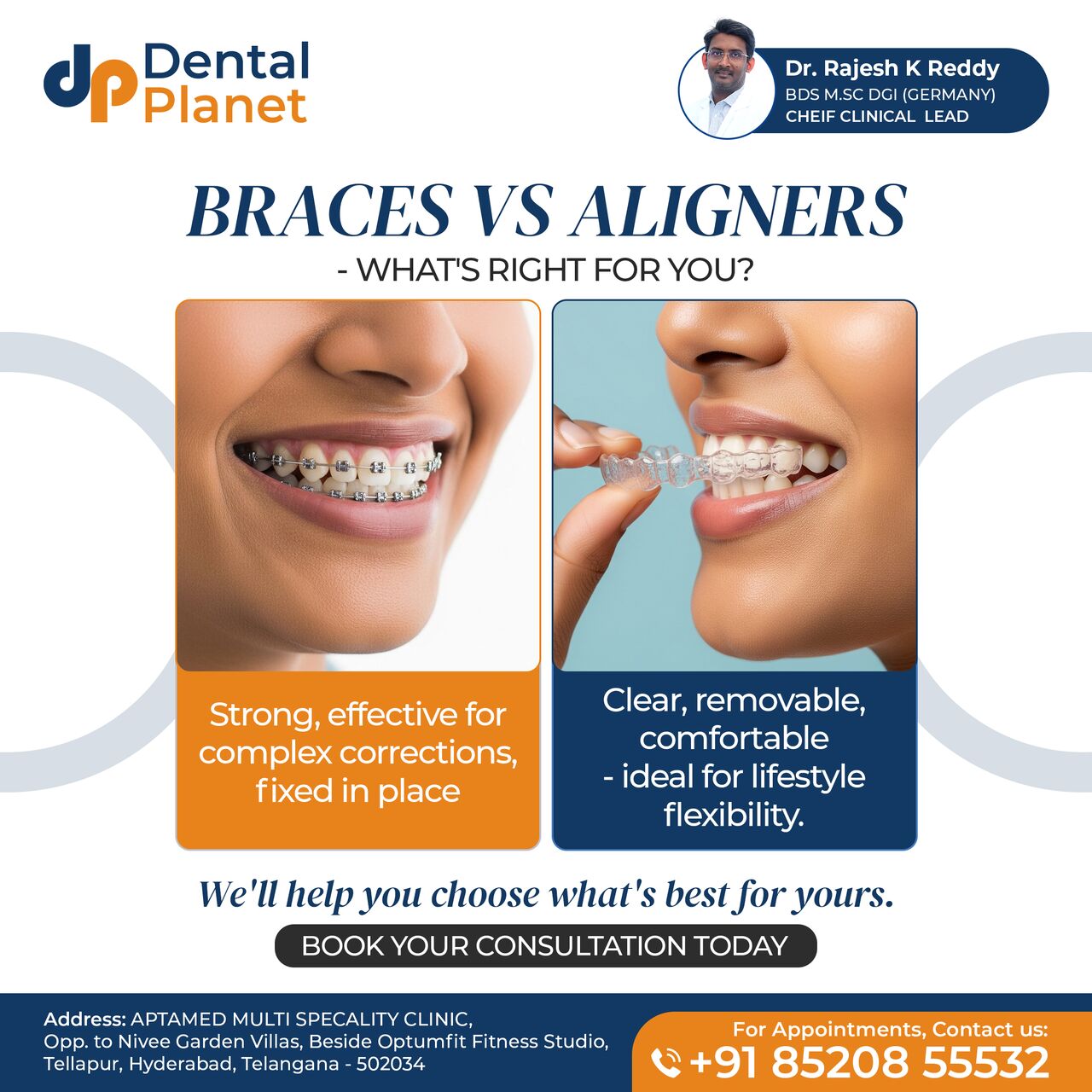 Hyderabad, Dental, Root Canal Treatment In Tellapur | Dental Planet