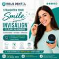 Invisalign Clear Aligners In Nagaram, Hyderabad | Risus Dental Clinic