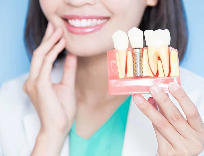 Chennai, Dental, Dental Implants For Missing Teeth In Kodambakkam, Chennai