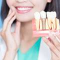 Dental Implants For Missing Teeth In Kodambakkam, Chennai