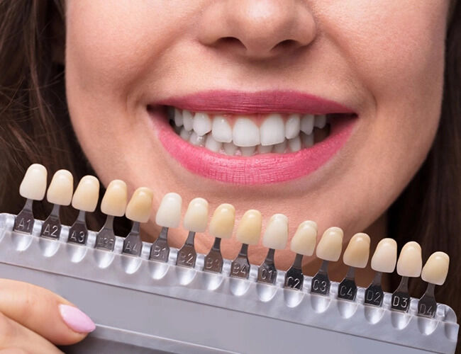 Chennai, Dental, Smile Design, Correction & Makeover In Kodambakkam