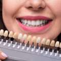 Smile Design, Correction & Makeover In Kodambakkam