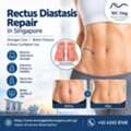 Book A Consultation For Rectus Diastasis Repair In Singapore