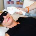 Alpha Laser Machine | Dermaspark