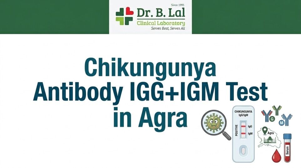 Lucknow, Health & Beauty Items, INR 1500,  Chikungunya Test In Agra | Affordable & Accurate | Dr. B. Lal Lab