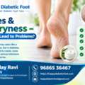 Diabetes & Foot Dryness &ndash; Can Dry Skin Lead To Problems?-Dr Uday Ravi