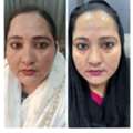 Best Skin And Laser Clinic In Delhi