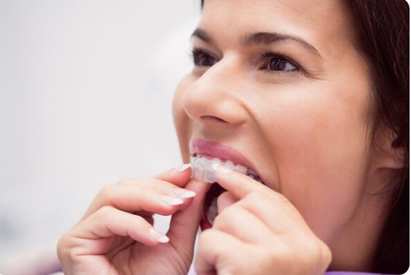 Mumbai, Health, How To Choose The Best Invisalign In Andheri