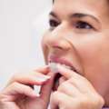 How To Choose The Best Invisalign In Andheri