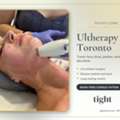 Ultherapy Toronto - HIFU Non-Surgical Facelift - Tight Clinic