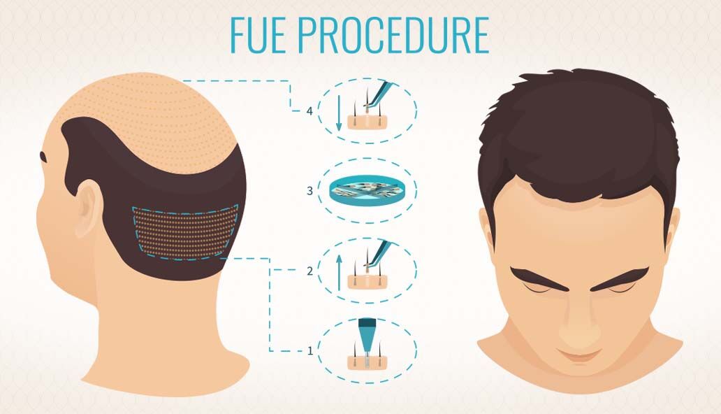 London, Beautician, Take The First Step Towards Fuller-Looking Hair!