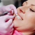 Personalised Dental Treatments In London
