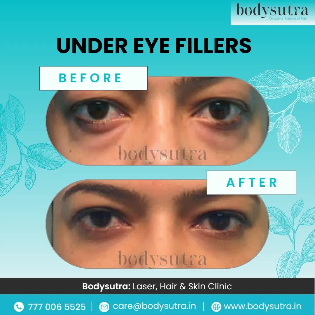 Pune, Health, Professional Skin Wellness Services For Every Concern