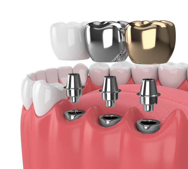 Madurai, Dental, Dental Clinic In Madurai