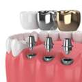 Dental Clinic In Madurai