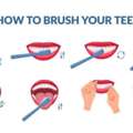 Best Dentistry In Madurai
