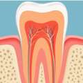 Invisalign Treatment