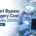 Heart Bypass Surgery Cost In India &ndash; Complete Treatment Guide