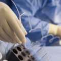 Laser Hatching In IVF In Bhagalpur For Better Embryo Implantation
