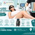 INR 3000,  Full-Leg Laser Hair Removal For Residents Near Civil Lines For Smooth Skin