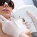 A Guide To Laser Hair Removal For Neck Hair