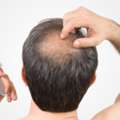 Hair Loss Treatment In Gurgaon &ndash; Citrine Clinic