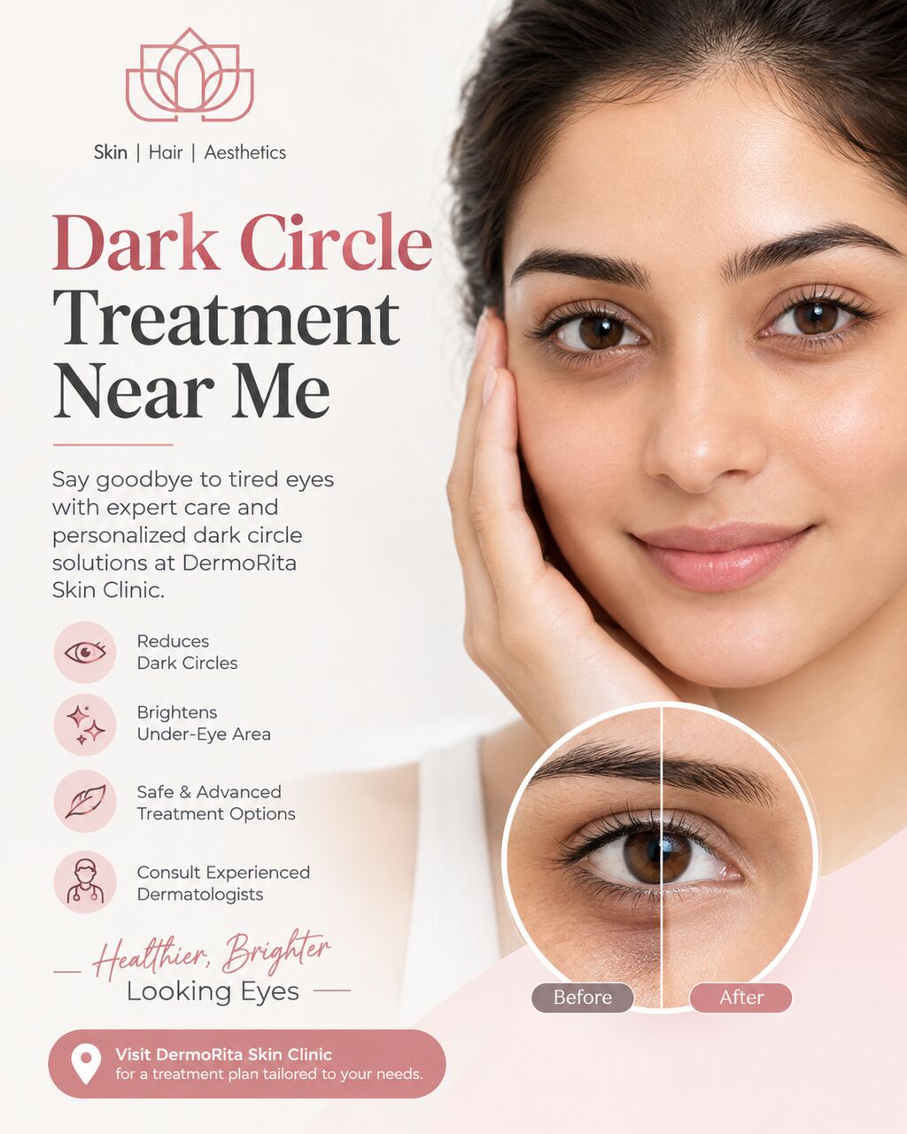 New Delhi, Health, Dark Circle Treatment Near Me | DermoRita Skin Clinic