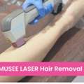 Laser Hair Removal Salon In Malaysia | MUSEE PLATINUM TOKYO