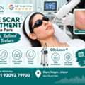 INR 2500,  Acne Scar Treatment Near Raja Park For Smooth Skin In Jaipur