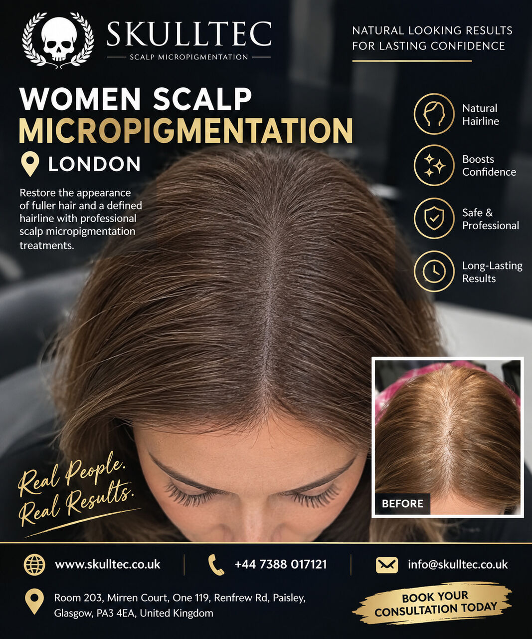London, Health, Women Scalp Micropigmentation London | Natural Hair Loss Solution